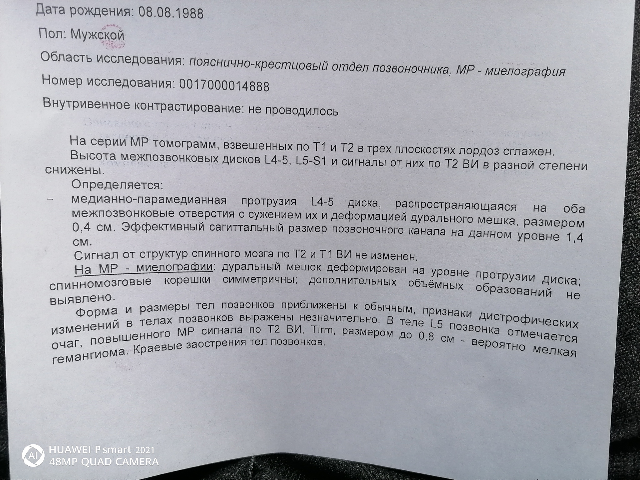 Как проявляется ущемление нерва при грыже диска в пояснице | Пикабу