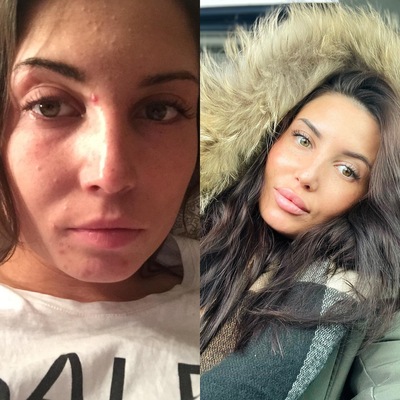 Иллюстрация к комментарию