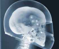 ������� ������������