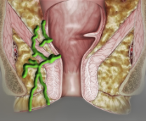 ���� ������ �����, �����������