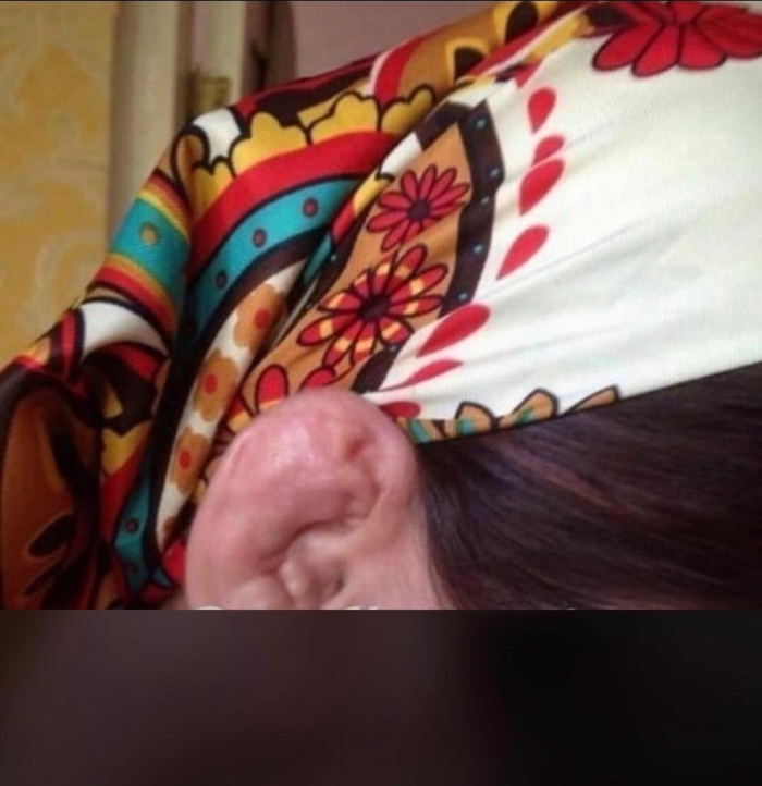   , 