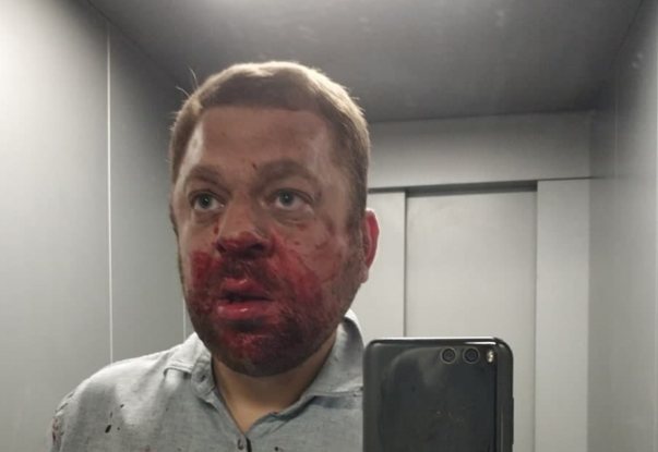 В ХМАО опасно быть независимым