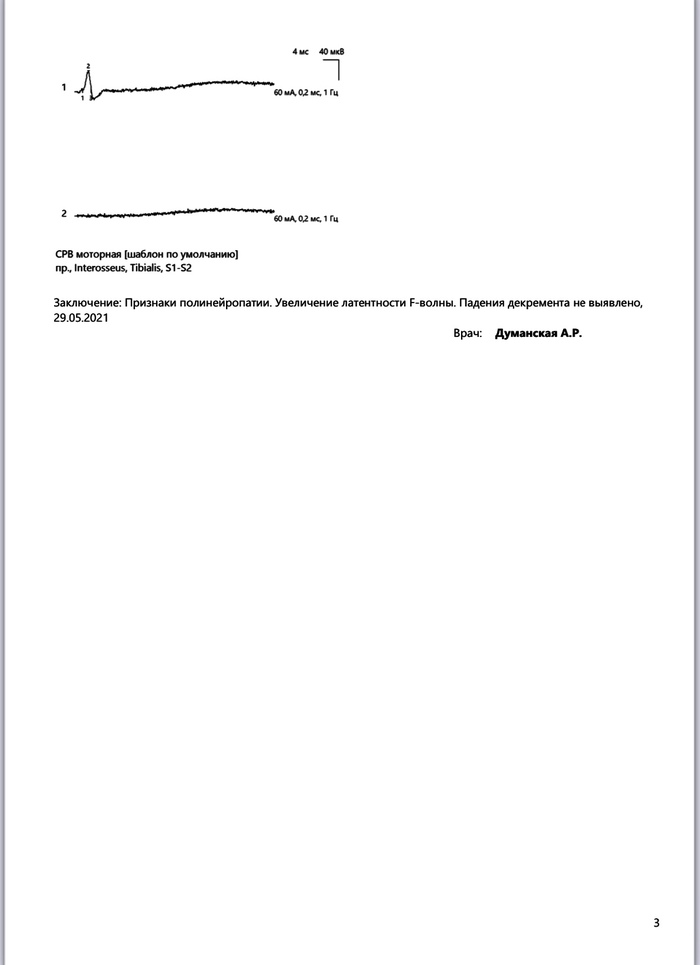 Можно ли лабрадору вареные кости есть