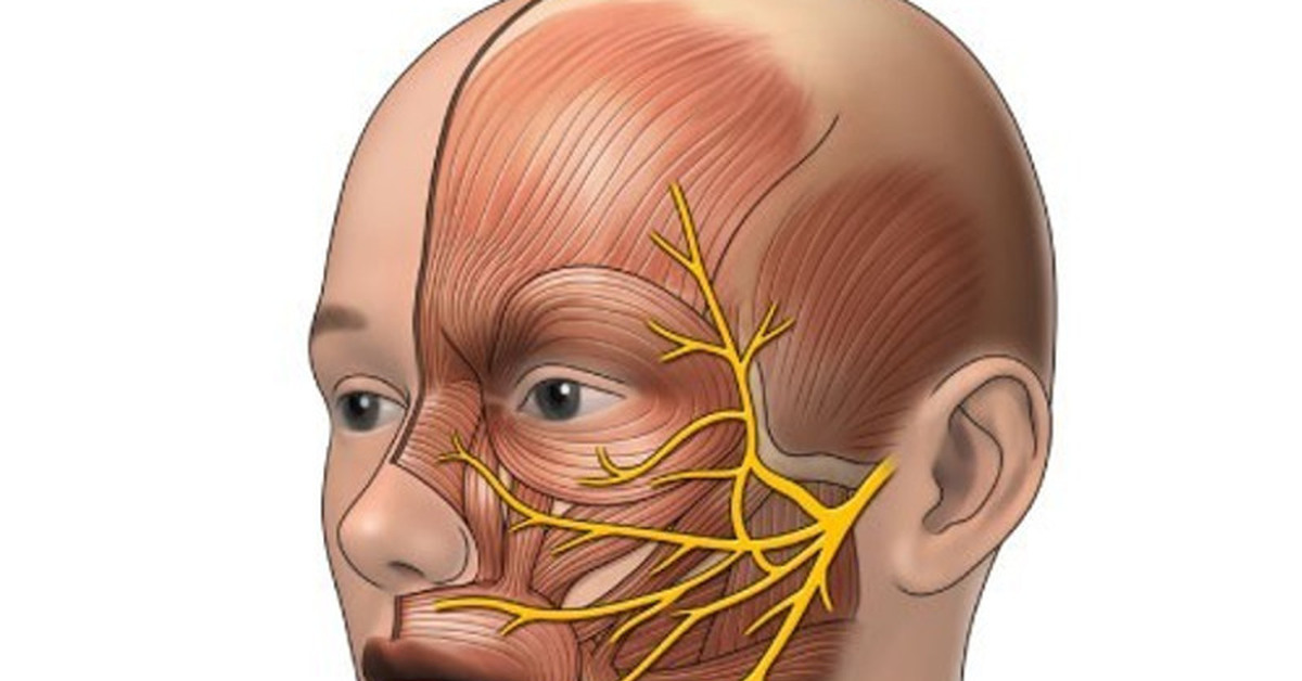 Невралгия щеки