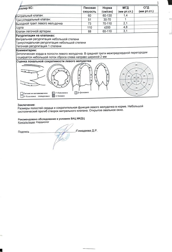 УЗИ сердца | Пикабу