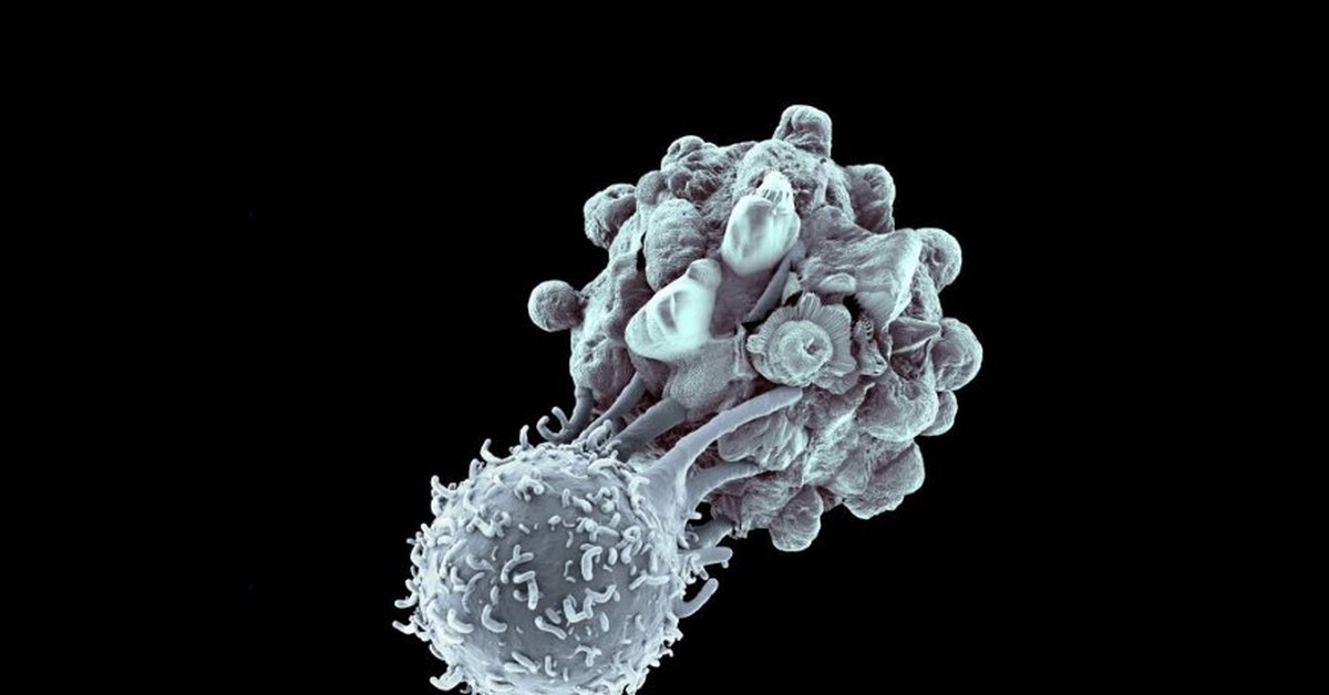 Макрофаги антитела. Клетки иммунной системы т-киллеры. Естественные киллеры это т лимфоциты. Естественные клетки киллеры фагоциты. Т киллеры клетки иммунитета.