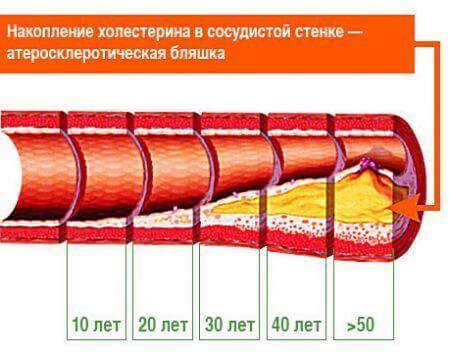 Что такое структурные жиры. Смотреть фото Что такое структурные жиры. Смотреть картинку Что такое структурные жиры. Картинка про Что такое структурные жиры. Фото Что такое структурные жиры