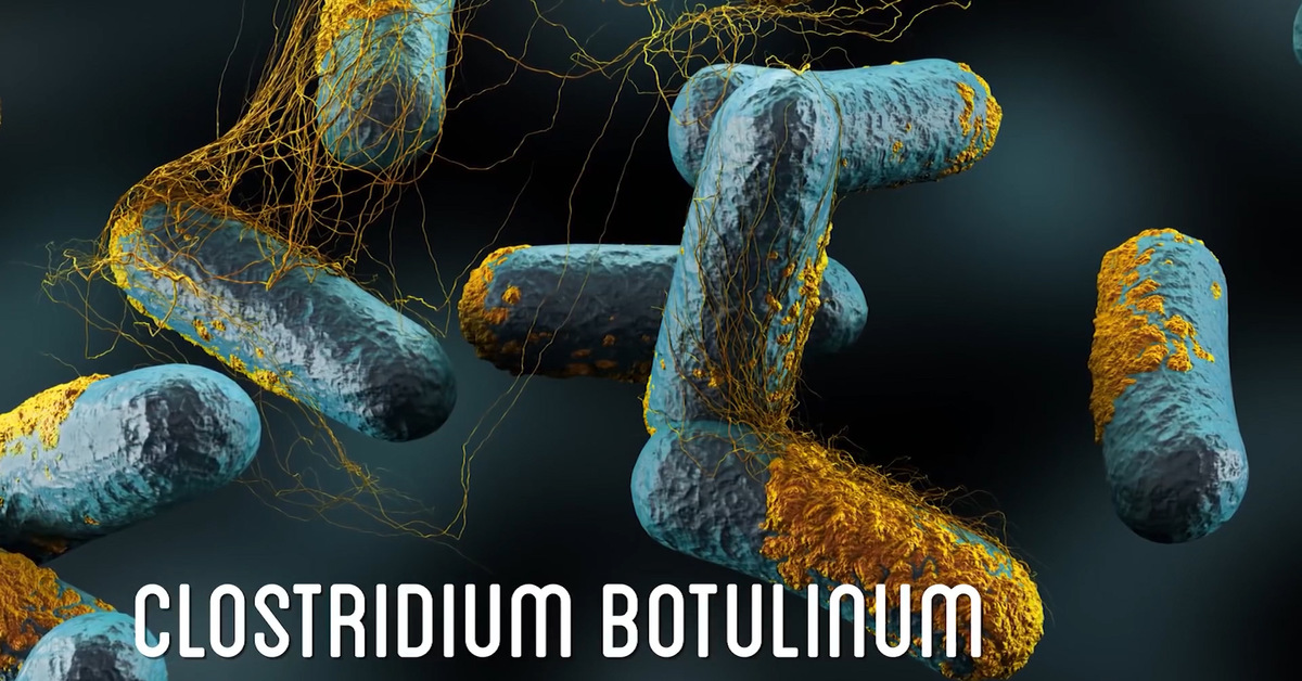 Пищевые токсикоинфекции ботулизм