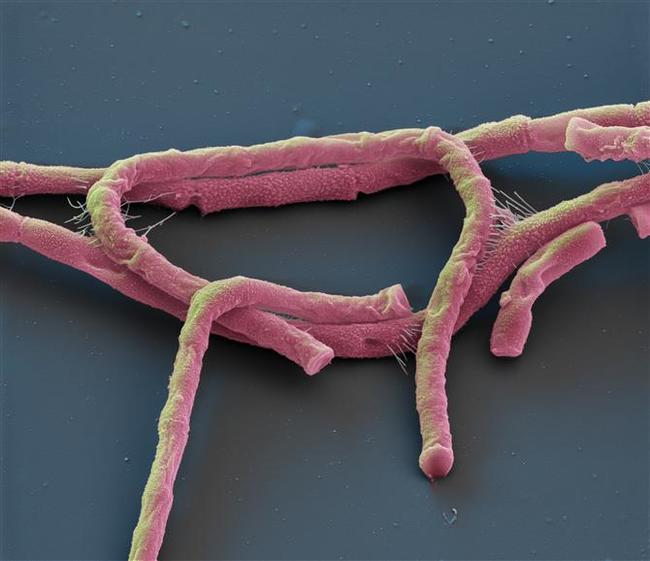    - Bacillus anthracis , ,  ,  