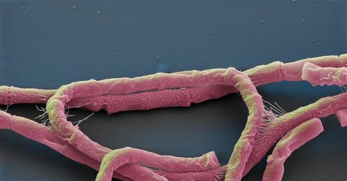 Бактерия вызывающая язву. Бацилла антрацис Сибирская язва. Bacillus anthracis, а22 (Сибирская язва). Бацилла сибирской язвы Bacillus anthracis. Бактерия сибирской язвы под микроскопом.