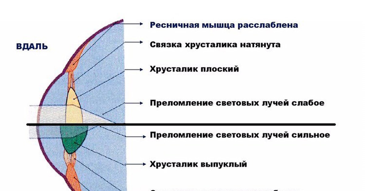 Что такое аккомодация глаза. Спазм аккомодации схема. Аккомодация хрусталика глаза. Механизм аккомодации глаза схема. Аппарат аккомодации глаза схема.