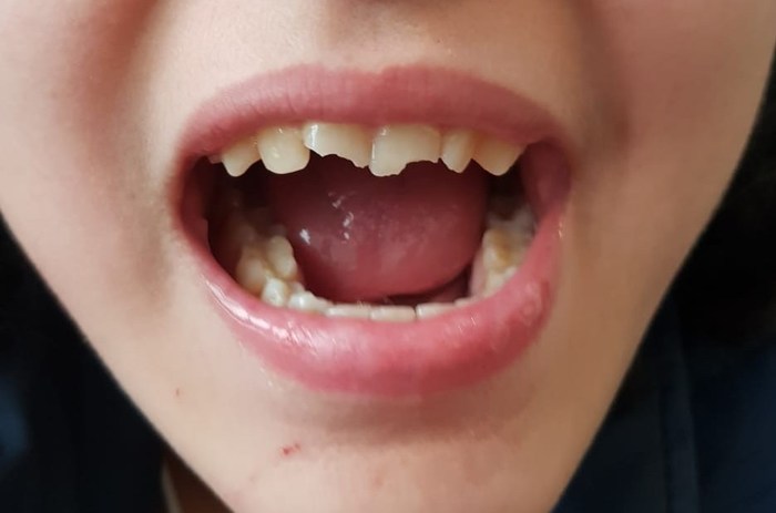      , , , , , , , , , 