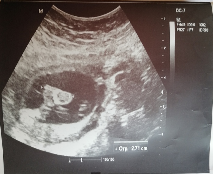 ������ ����, �� �� ���� ����������