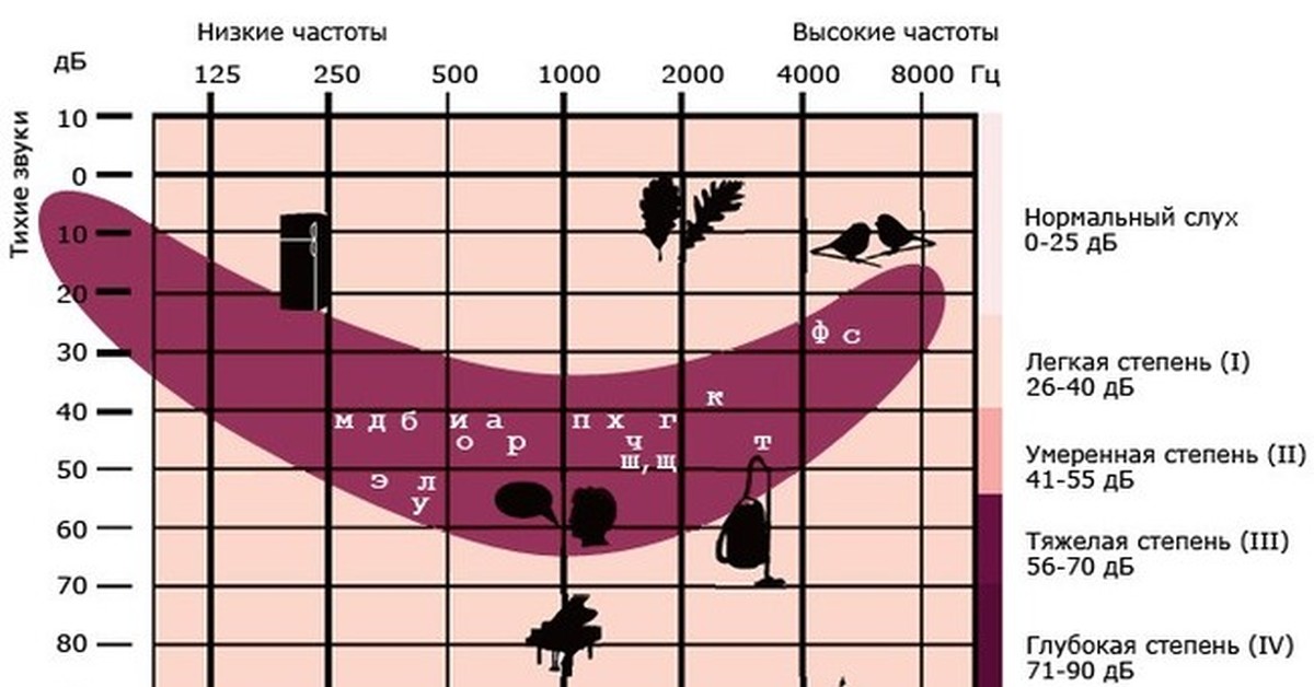 Тугоухость: степени, симптомы, лечение