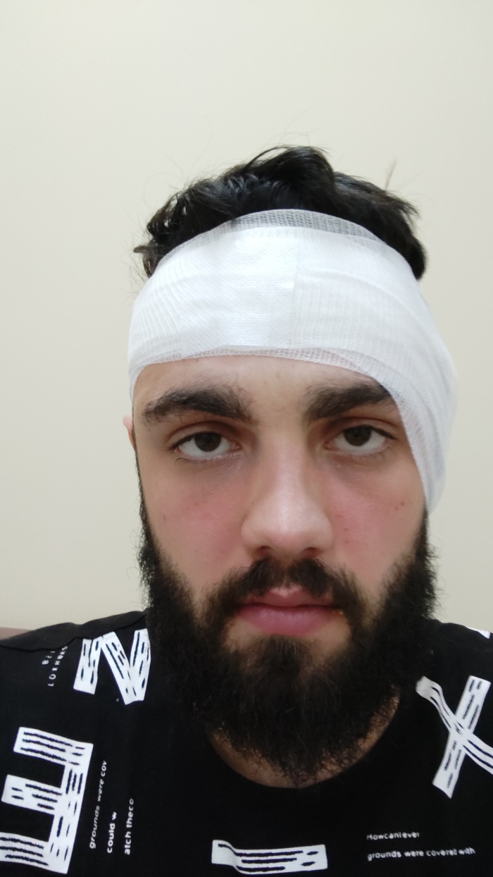 Что будет с голосом после удаления гланд. 1633737896140140188. Что будет с голосом после удаления гланд фото. Что будет с голосом после удаления гланд-1633737896140140188. картинка Что будет с голосом после удаления гланд. картинка 1633737896140140188.