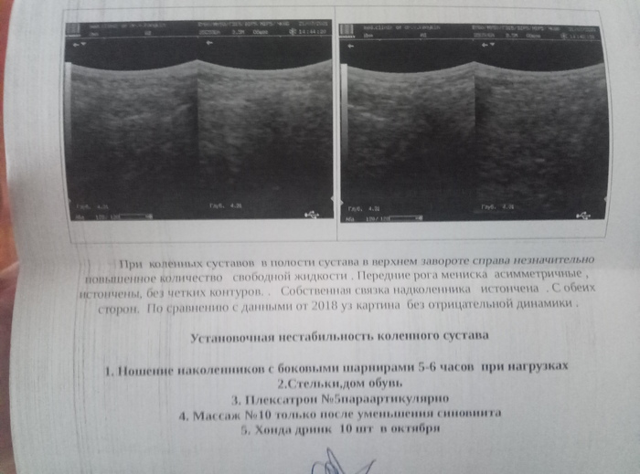 История о лечении коленей или семь лет хождений по мукам