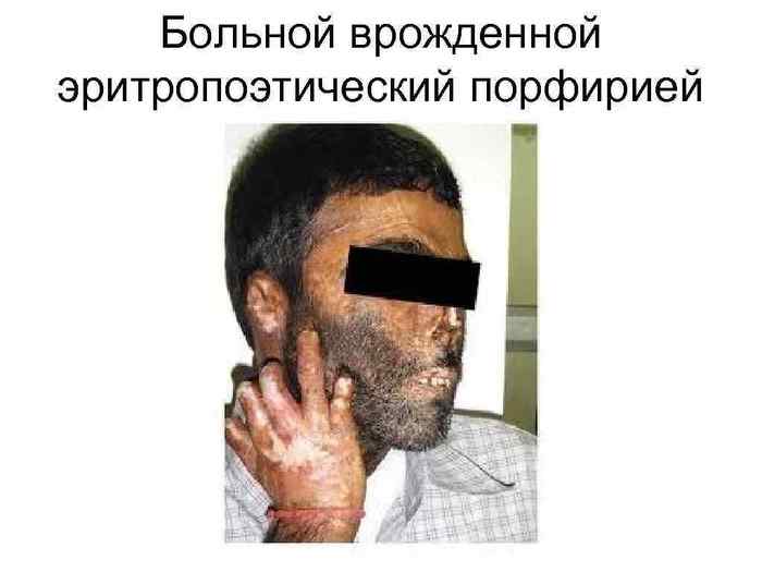 мем про роды и яйца. 1635336068146616201. мем про роды и яйца фото. мем про роды и яйца-1635336068146616201. картинка мем про роды и яйца. картинка 1635336068146616201. Я так в 11 классе ударил по паху одного, второго уже в голову. Их было двое на меня одного. Ну подрались и подрались, они хотели наехать, я отбился. Дело было после уроков, отбился и ушел домой. Ничего не подозревая пришел с утра в школу и попал в замес.