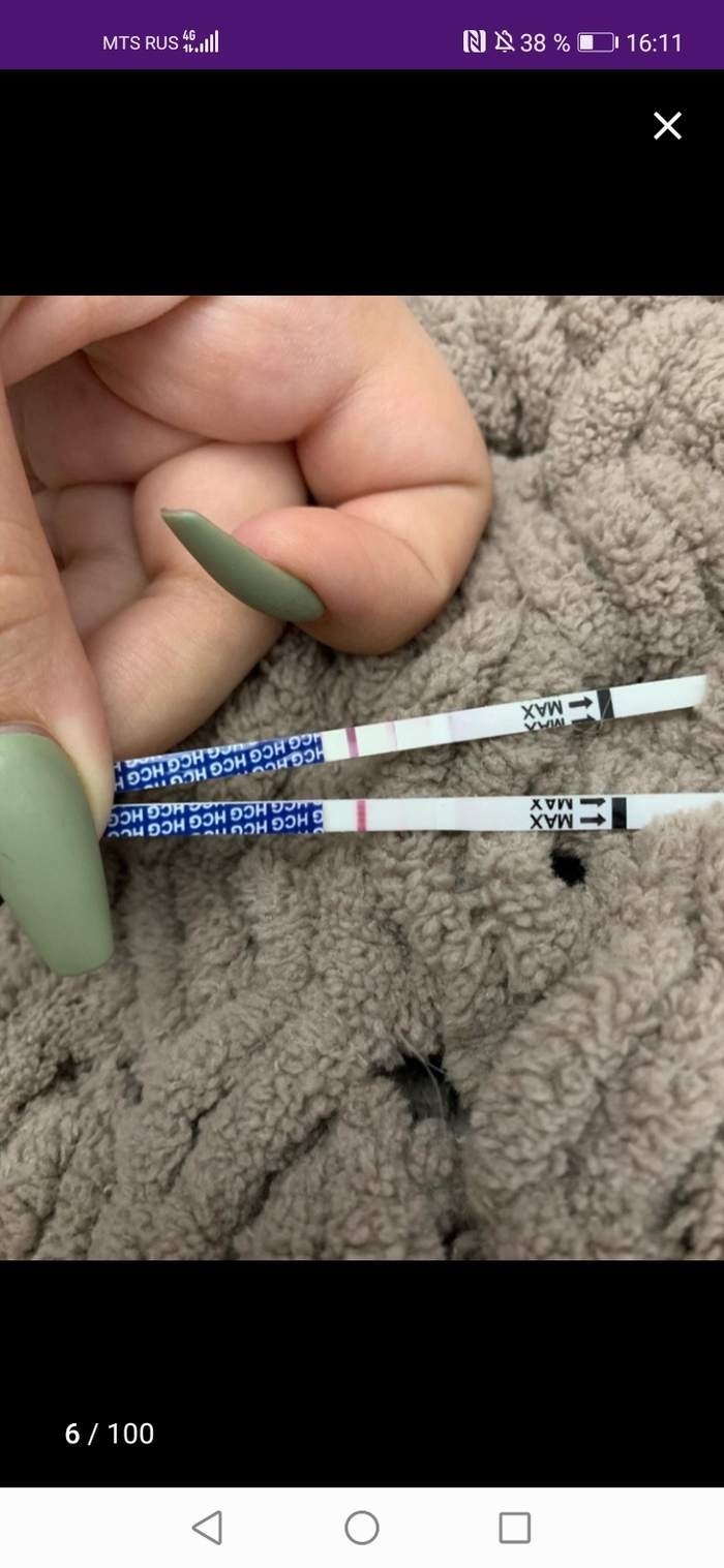 С пивком потянет что значит. 1636709132198324793. С пивком потянет что значит фото. С пивком потянет что значит-1636709132198324793. картинка С пивком потянет что значит. картинка 1636709132198324793. О существовании такого явления, как пивной алкоголизм, слышать доводилось не всем. Более того — многие очень сильно удивляются, впервые услышав, что «безобидное» пиво, которое считается едва ли не детским напитком, тоже может вызывать зависимость. Так чем же является этот самый пивной алкоголизм, каковы его признаки, насколько опасно такое состояние и поддаётся ли оно лечению? С пивком потянет что значит. 1636709132198324793. С пивком потянет что значит фото. С пивком потянет что значит-1636709132198324793. картинка С пивком потянет что значит. картинка 1636709132198324793. О существовании такого явления, как пивной алкоголизм, слышать доводилось не всем. Более того — многие очень сильно удивляются, впервые услышав, что «безобидное» пиво, которое считается едва ли не детским напитком, тоже может вызывать зависимость. Так чем же является этот самый пивной алкоголизм, каковы его признаки, насколько опасно такое состояние и поддаётся ли оно лечению?