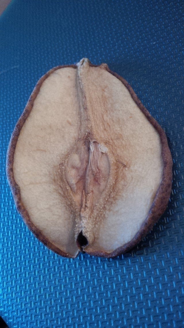 Трепанация это модно))