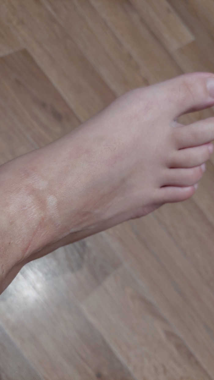 Как я по гаражам лазила. Ответ StaPerRa в «Ошибка выжившего»