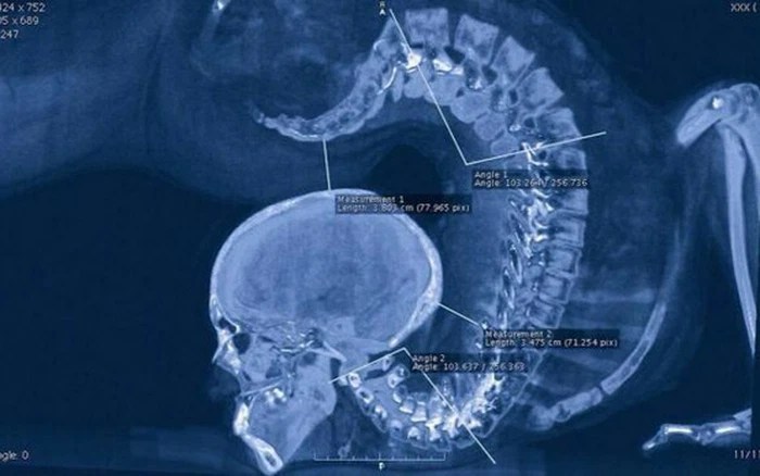 Медицинские технологии на службе у искусства: как Ник Визи творит чудеса с помощью рентгена