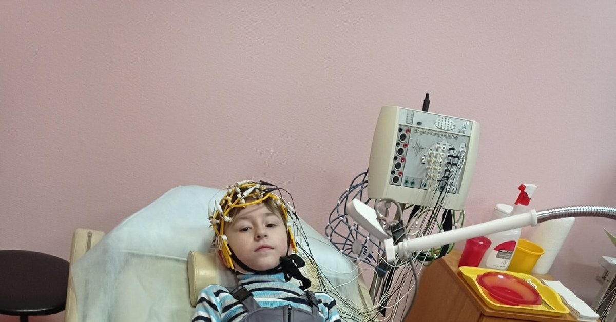 ЭЭГ, и первые лекарства от эпилепсии | Пикабу