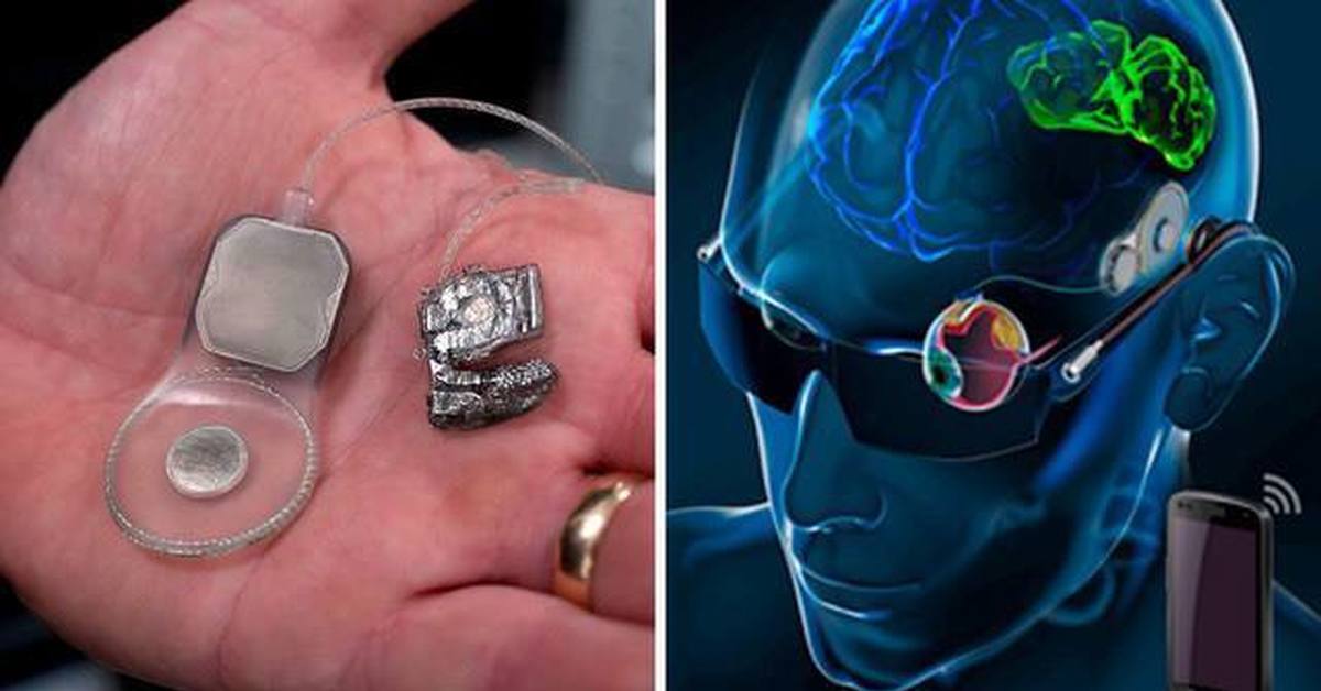 Бионический глаз | Пикабу