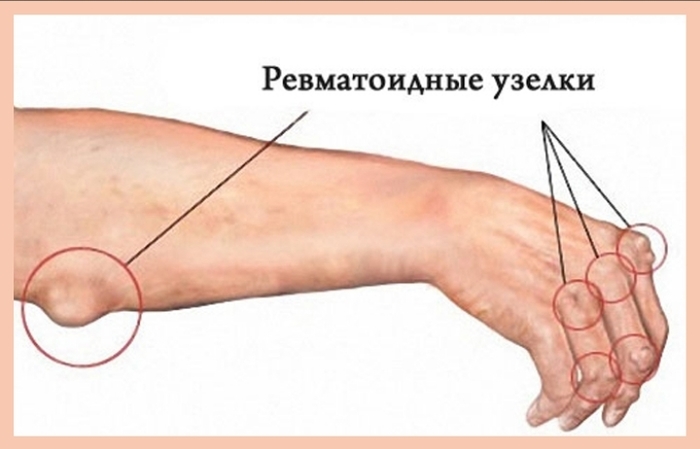 Просто хотел показать что умею пальцами