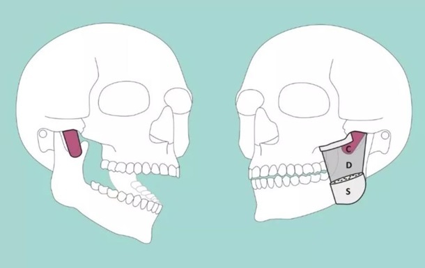 В теле человека нашли новую мышцу