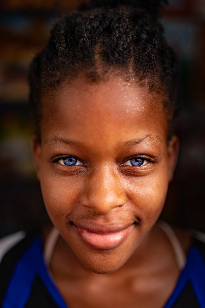Чернокожая девочка с редкой мутацией Фотография, Доминикана, Чернокожие, Портрет, Мутация, Голубые глаза, Длиннопост