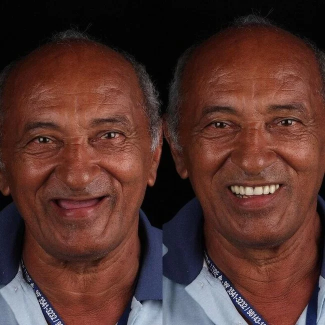 Дантист из Бразилии возвращает красивые улыбки людям, которые не могут оплатить операции Стоматолог, Гуманитарная помощь, Добрые дела, Длиннопост