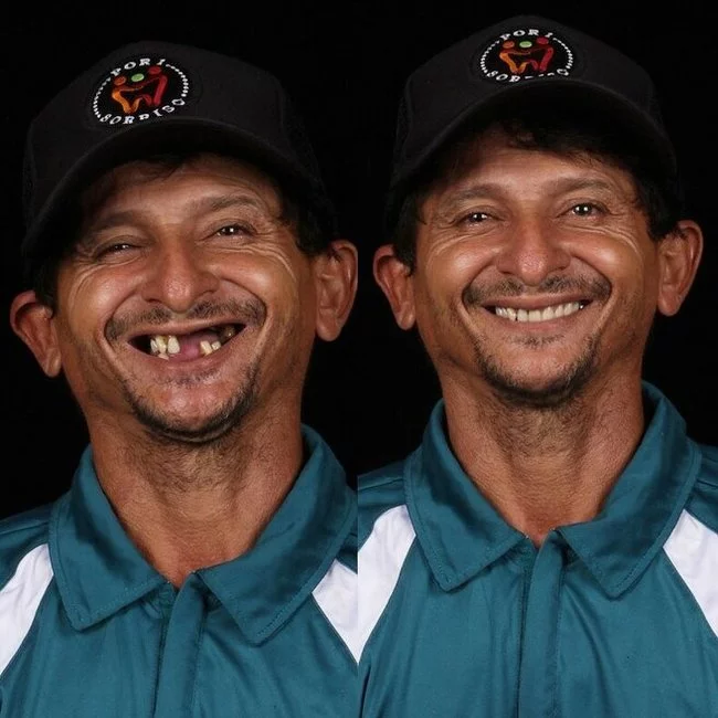 Дантист из Бразилии возвращает красивые улыбки людям, которые не могут оплатить операции Стоматолог, Гуманитарная помощь, Добрые дела, Длиннопост