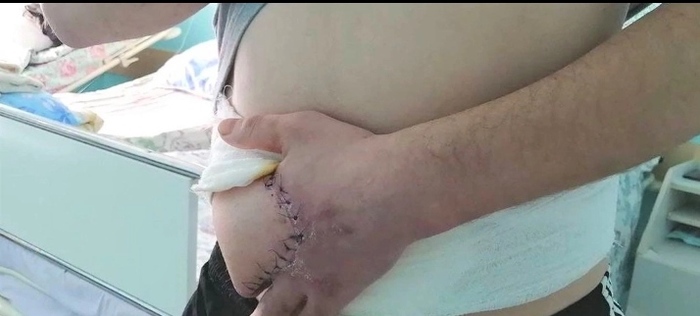    , 