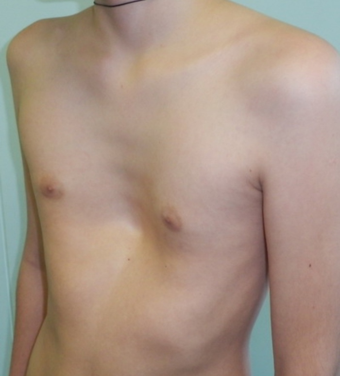 ���������� ������� ������