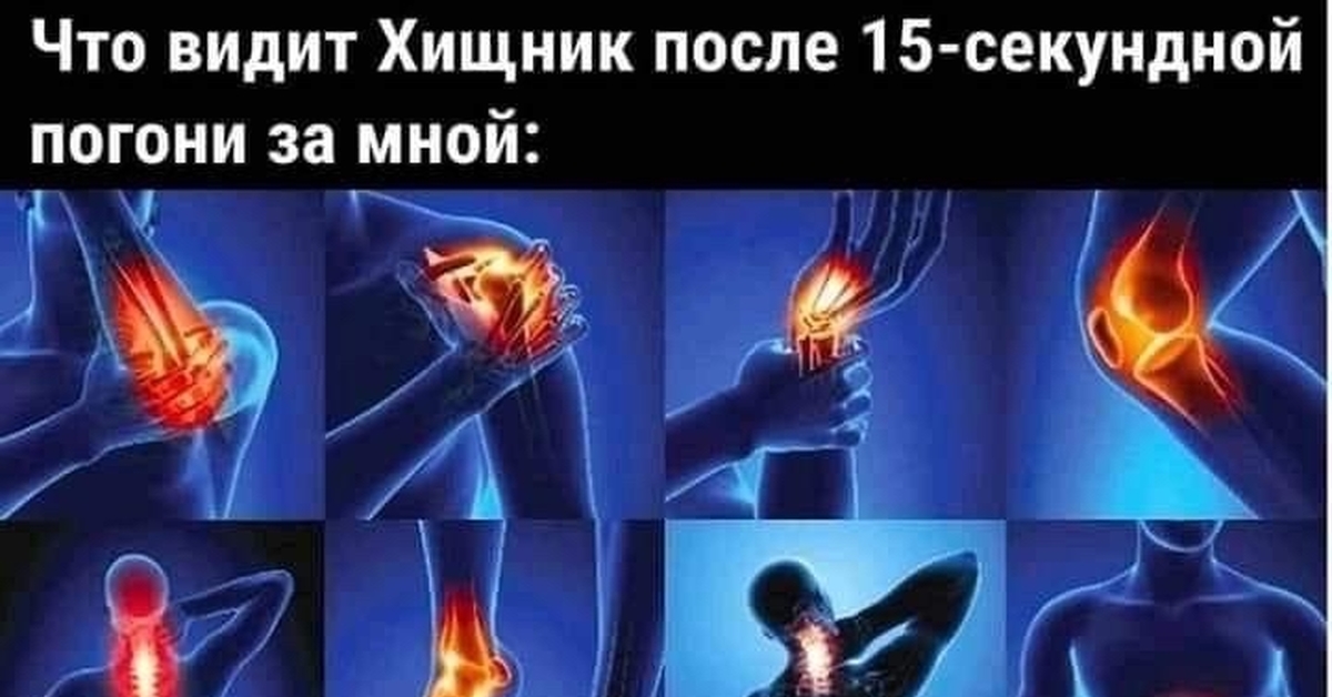 Pain's. Коллаж больные суставы. Joint Pain. Inflammation and Pain. Human Joint Pain.