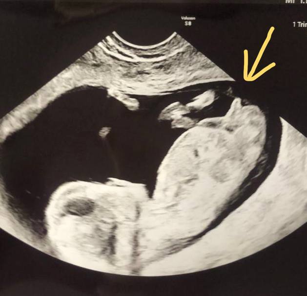 Ответ на пост «Обидно...»