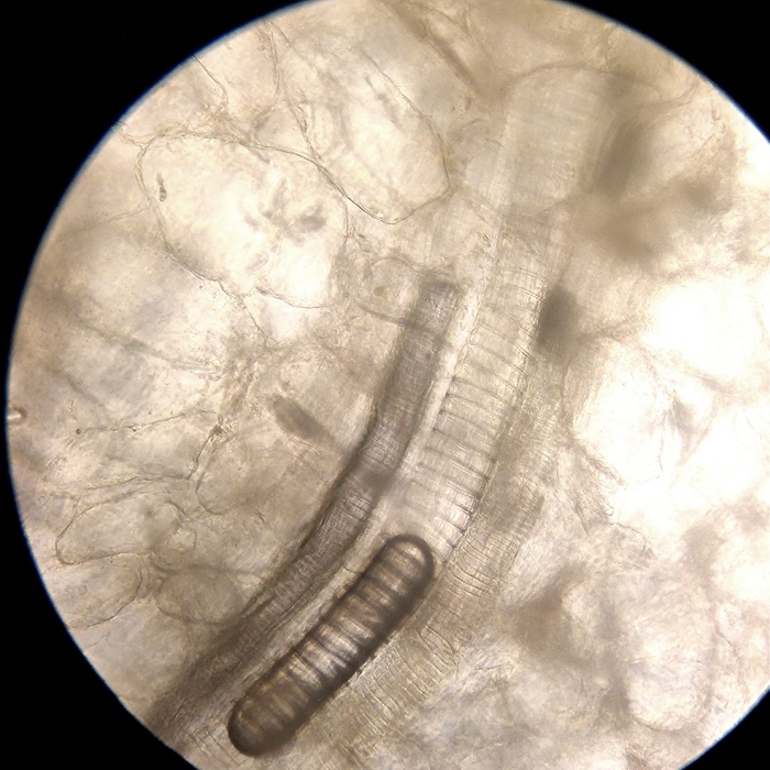 Червь, моль или бактерия?