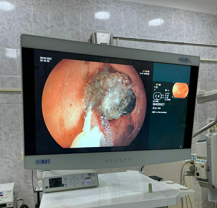 ��������� ����� ������ ����� �������, ������������� ���������