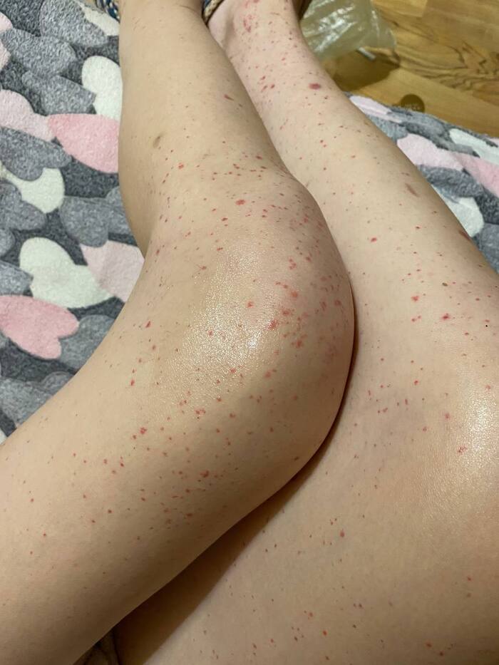 Нужна консультация врачей (не срочно)