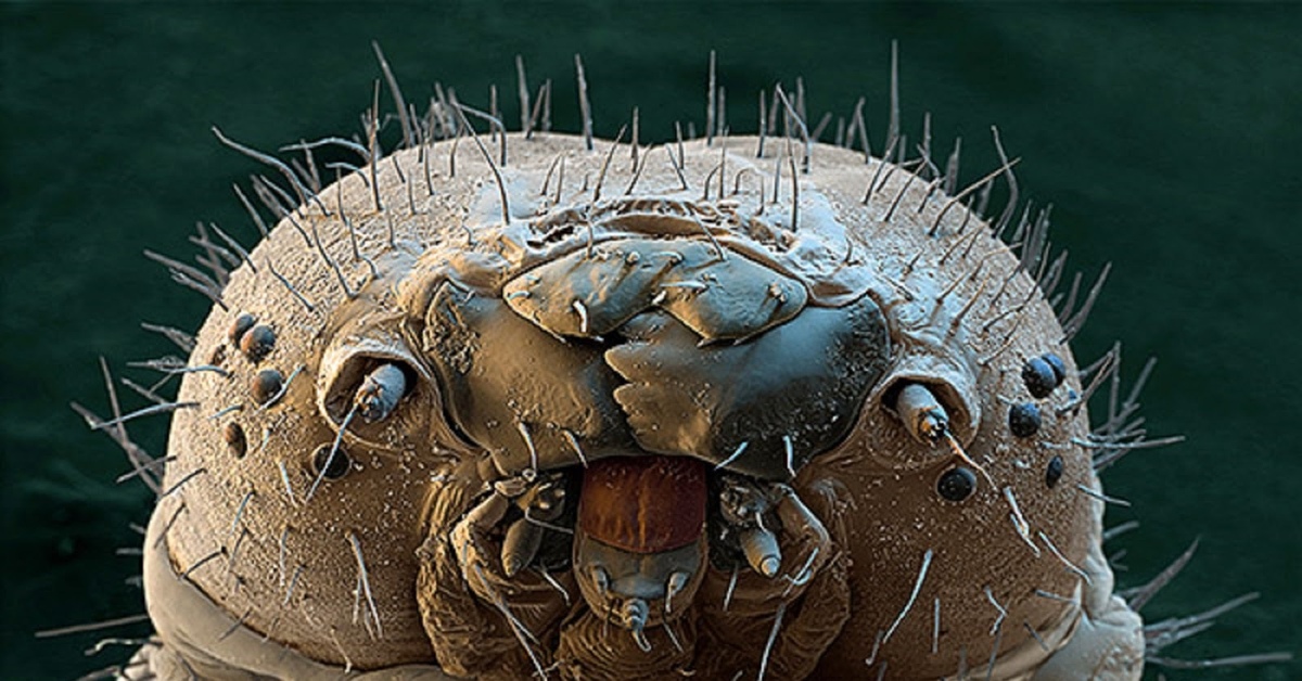 Муравьи черви. Микробы через микроскоп. Микробы под ногтями под микроскопом. Насекомые под микроскопом.