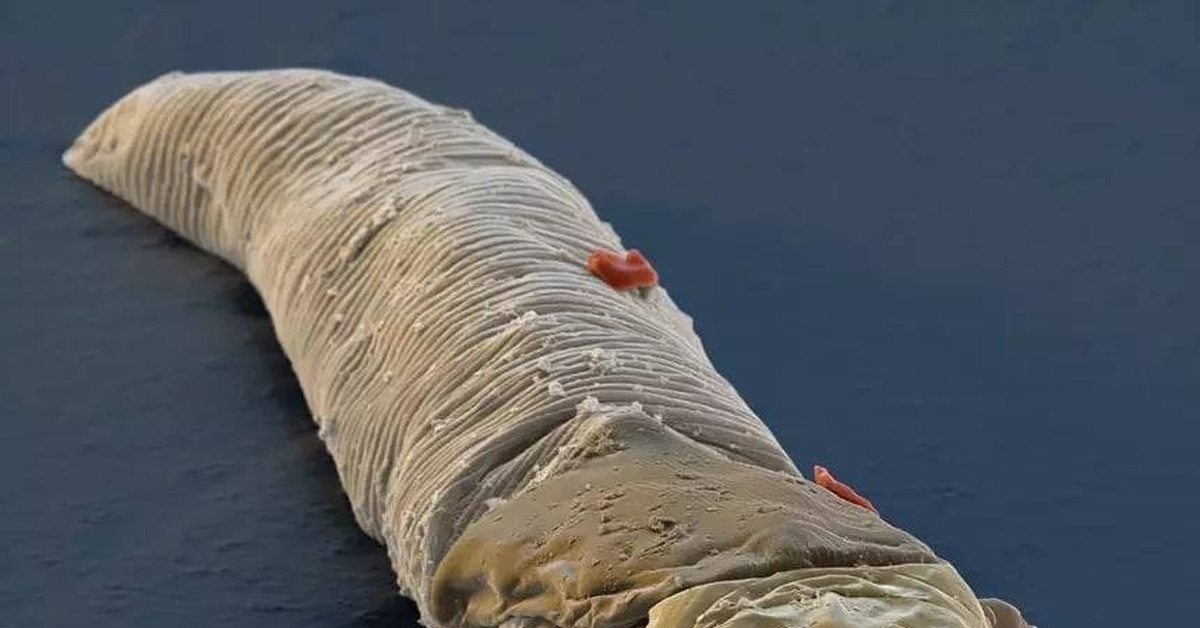 Подкожный клещ демодекс. Демодекс железница угревая. Угревая железница что это такое. Железница угревая латынь. Железница угревая под микроскопом.