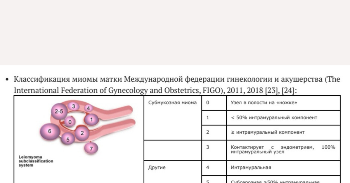 Миома 5 тип по figo