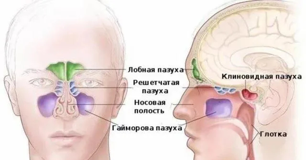 Синус симптомы. Гайморовы пазухи анатомия гайморит. Клиновидная пазуха анатомия. Сфеноидит воспаление клиновидной пазухи. Синусит решетчатой пазухи.