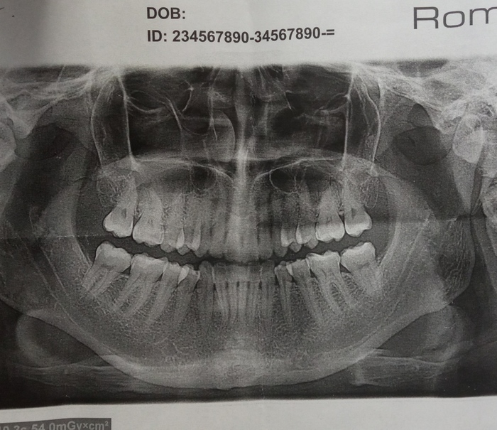 ������ ��� ������� ��� ���� ��������