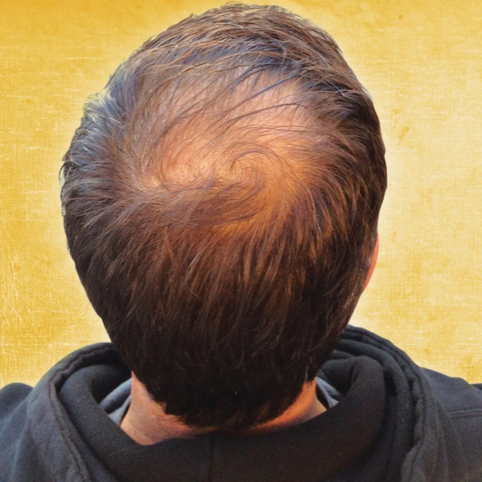 Ответ на пост «Внезапно»