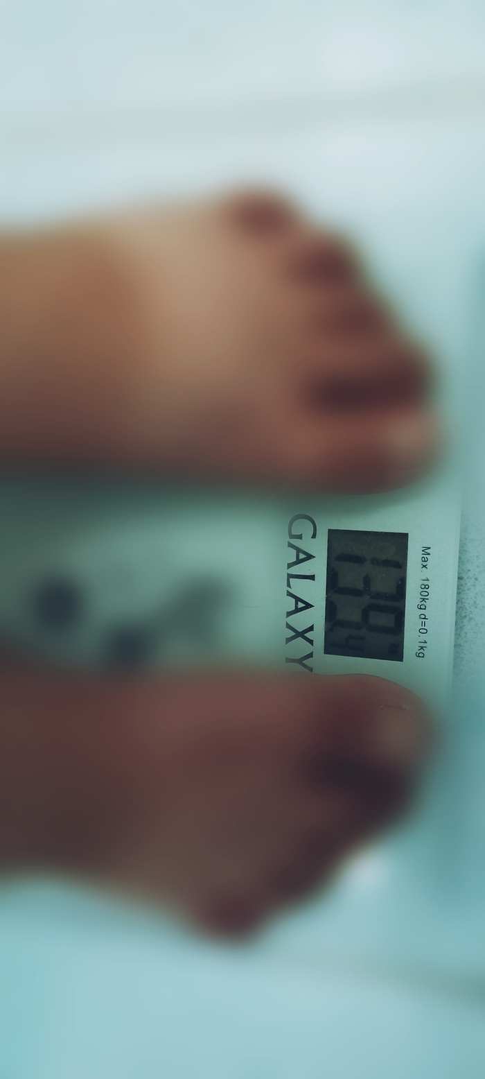 140 кг уродства Похудение, Фотография, Длиннопост, Лишний вес