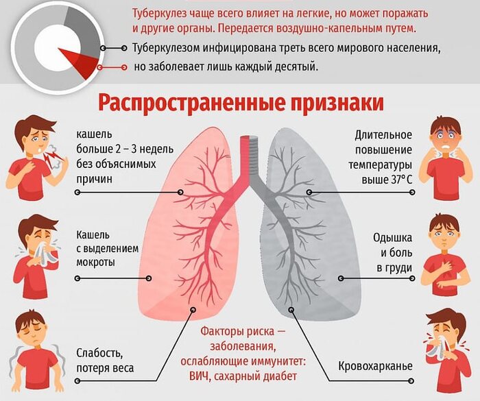    Help Stop TB ( ) , , Wcg, Boinc, , 