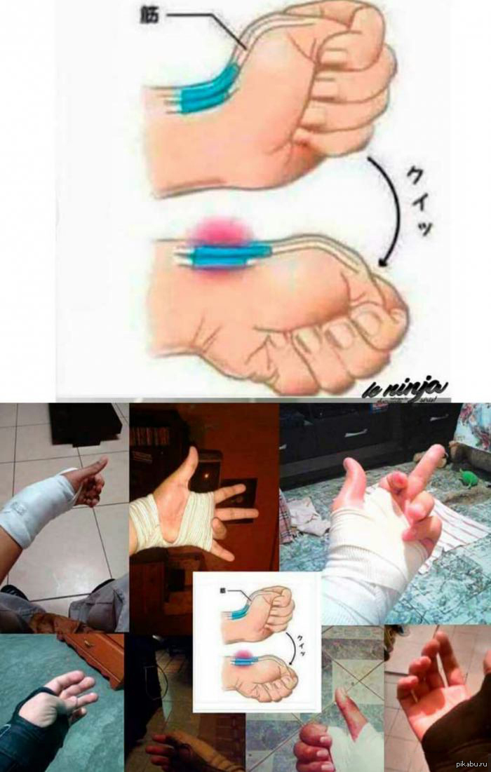 ������ ���������� ����� ���������