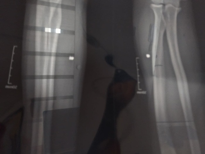 ������ ����