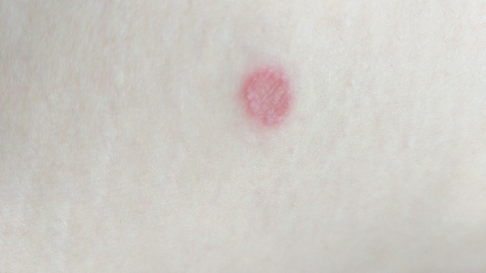 ��� ��� ?